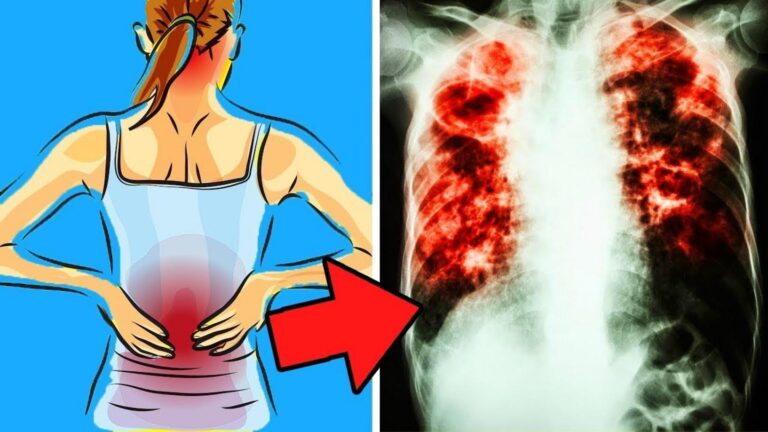 Cette astuce simple révèle des signes cachés d&rsquo;une pneumonie à ne pas ignorer…