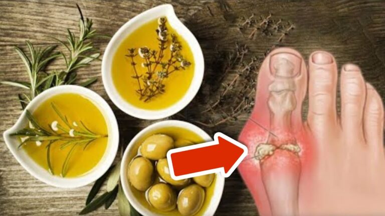 8 astuces simples pour réduire l&rsquo;excès d&rsquo;acide urique et mieux se sentir !