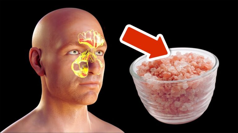 Éliminez 1 ingrédient et dites adieu au mucus mal placé en un clin d&rsquo;œil !