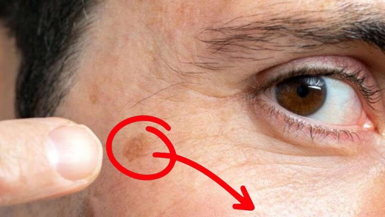 Éliminez 5 types d&rsquo;affections cutanées avec cet huile miracle en 1 nuit !
