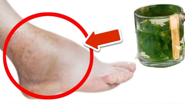 5 astuces de thé pour soulager les jambes et pieds enflés une bonne fois pour toutes