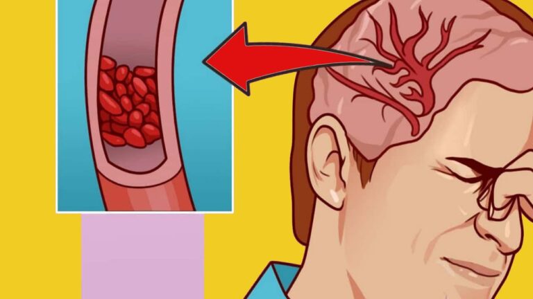 10 signes surprenants que ton corps réclame plus de magnésium !