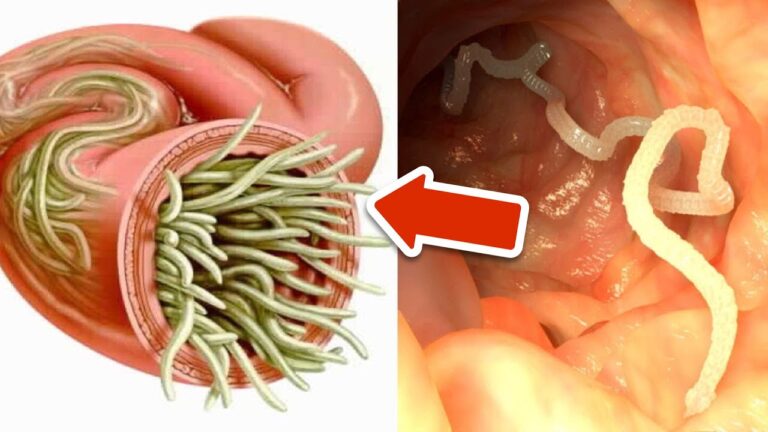 7 plantes étonnantes pour éliminer naturellement les parasites !