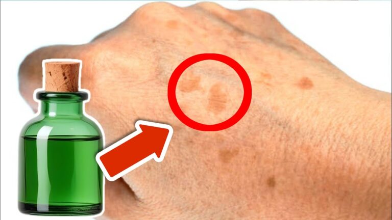 5 huiles miracles pour éliminer les taches de vieillesse facilement !