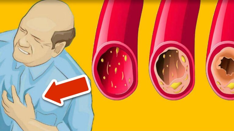 11 aliments magiques pour nettoyer vos artères rapidement et naturellement !