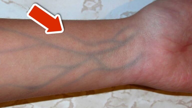 5 signes d&rsquo;une mauvaise circulation sanguine à ne jamais ignorer !