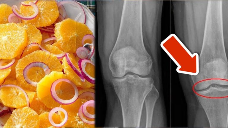 8 astuces simples pour renforcer vos genoux et éviter les blessures !