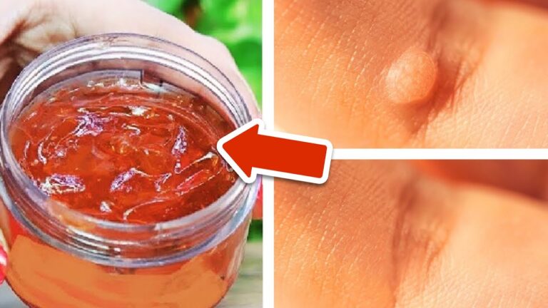 Éliminez 1 virus de la peau : la méthode révolutionnaire avec un simple ingrédient !