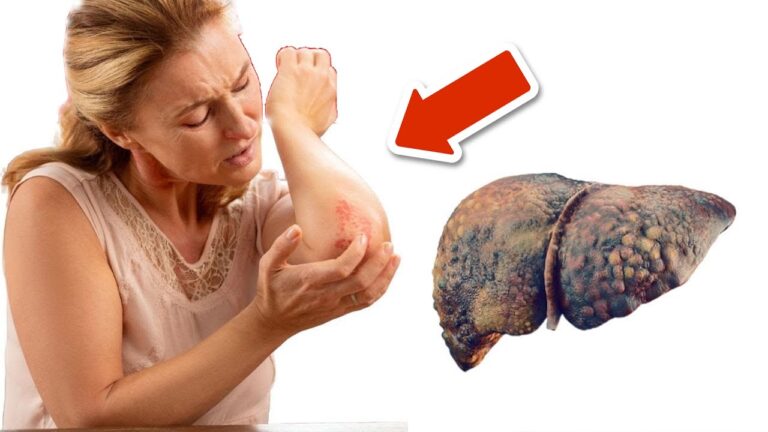 5 Signes révélateurs d&rsquo;une levers malade sur ta peau et tes jambes !