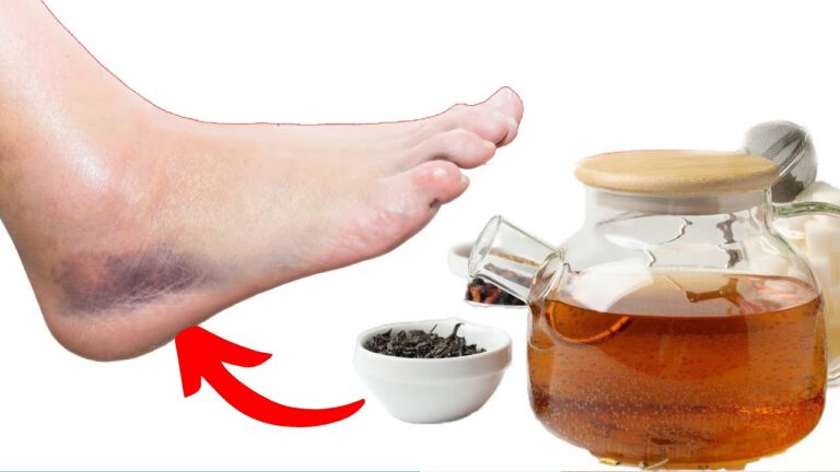 7 tisanes pour dire adieu aux jambes et pieds gonflés ! Découvrez notre sélection.
