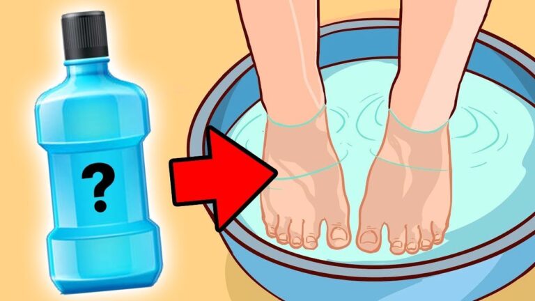 Libérez-vous du nail fungus en 3 étapes faciles et efficaces !