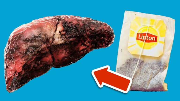 7 dangers cachés de ce thé : protégez votre foie dès aujourd&rsquo;hui !